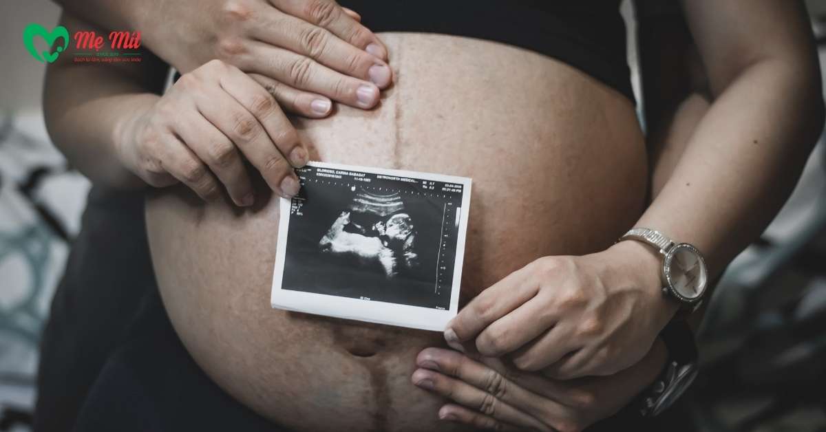 Bà bầu cần lưu ý gì?