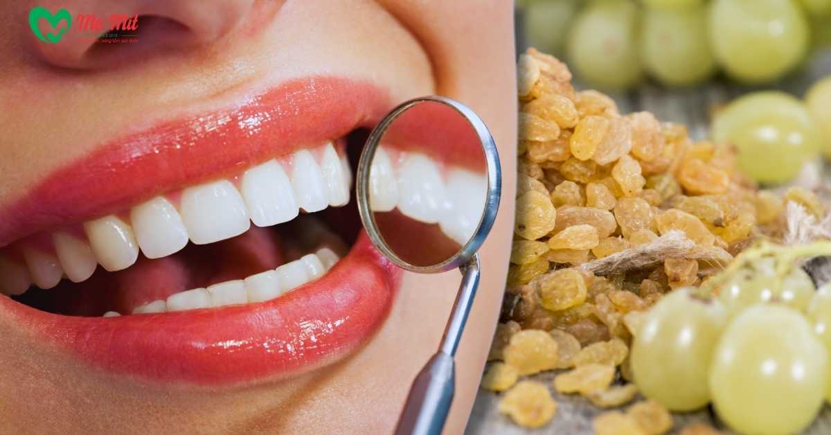 Nho khô có thể hỗ trợ duy trì sức khỏe của hàm răng.